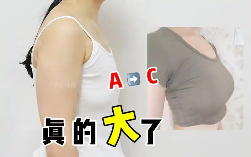 【李朕】自体脂肪丰胸60天,我的胸真的变大了
