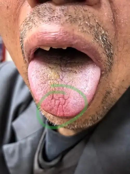 这个老大爷,是保洁,风一吹就拉肚子,夹不住