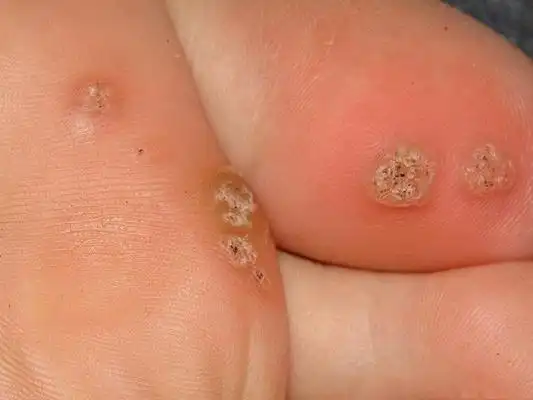 刺猴初期各种图片50