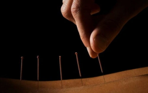 针灸对腰椎间盘突出症患者有什么用