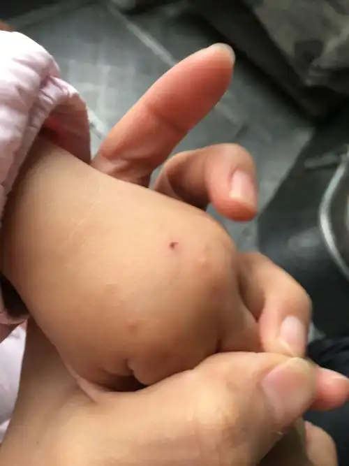 宝宝长肉粒,回老家才长的