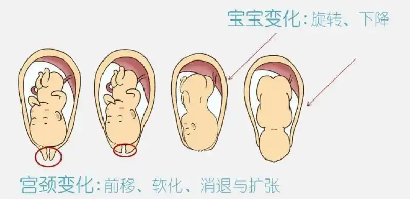 晓妍说怎样理解分娩中的枕后位