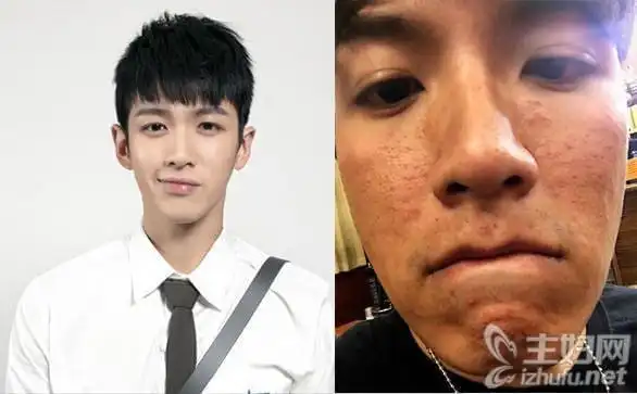 【柯震东素颜】柯震东素颜照烂脸满脸的痘痘太吓人_0