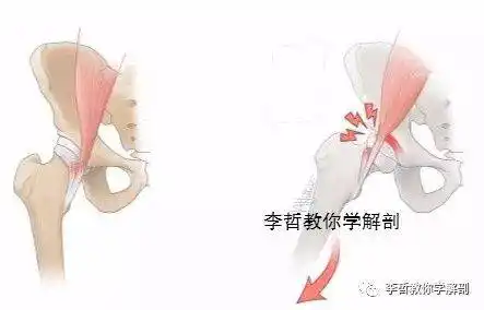 响,响,响,弹响髋到底是什么原因引发?