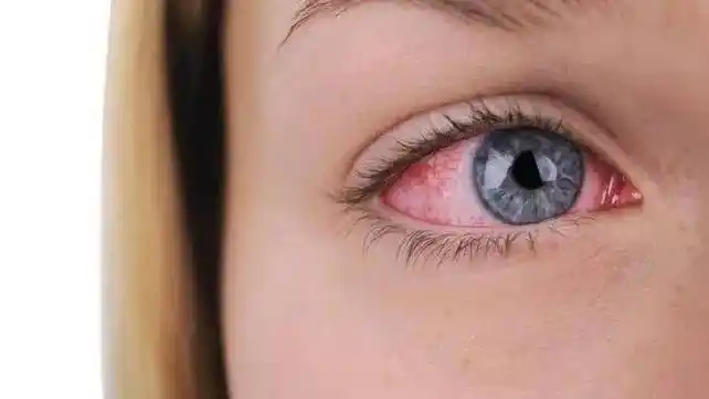 一文读懂 | 干燥综合征的识别与自我管理_唾液腺_症状_功能