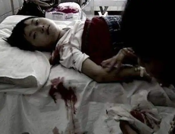 小苏丽事件是真的吗?小苏丽验尸照片(死后遭亲生母亲扒坟)