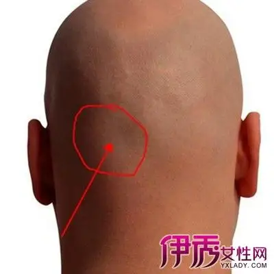 >> 文章内容 >> 后脑痛是什么原因 一般后脑勺痛会是什么病答:如果