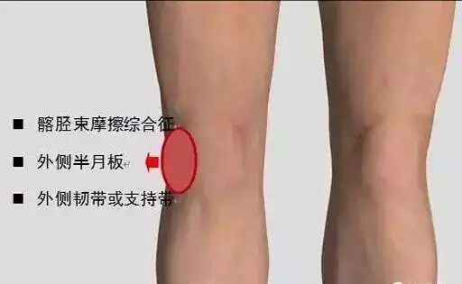 你的"膝盖痛"到底是怎么回事?