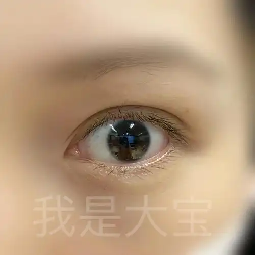 全网最小瞳孔测评卡士达棕