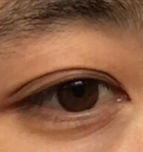 为什么有的中国人的眼珠是黄棕色的.