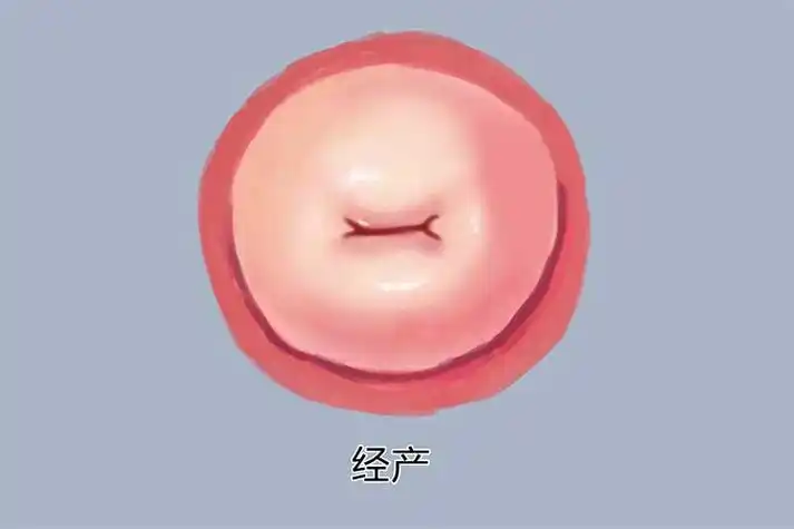 宫颈口正常图片是什么样子_有来医生