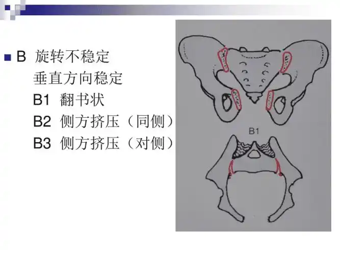 骨盆x线投照技术pptppt