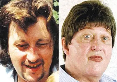 雌激素分泌过多 男子自然变女人[图]