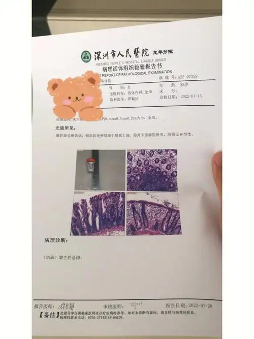 肠胃镜幽门螺旋杆菌都安全下车0606,今天拿的肠息肉报告是普通