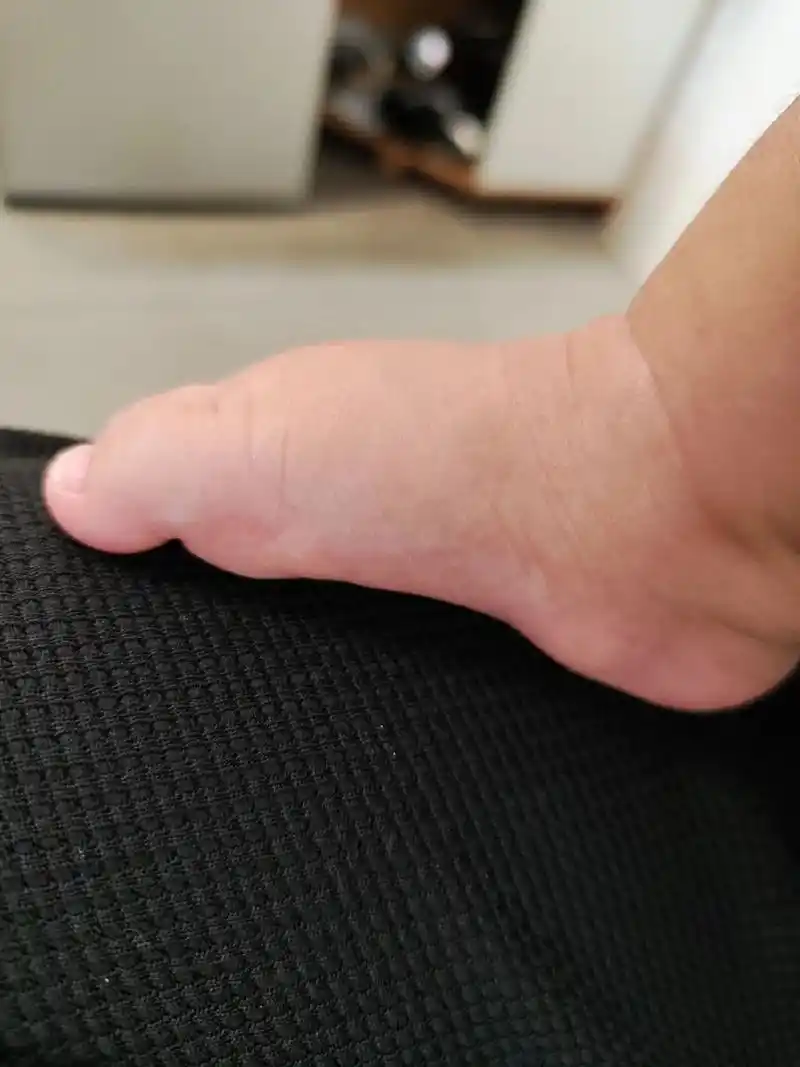 宝宝小jiojio.三个半月宝宝两个脚脚踝下面有凸出一个圆圆 - 抖音