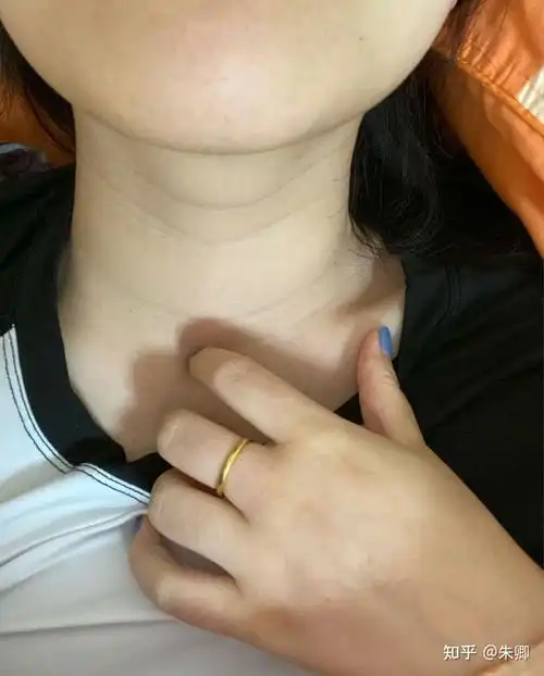 是看不下去我脖子上一圈圈的年轮.