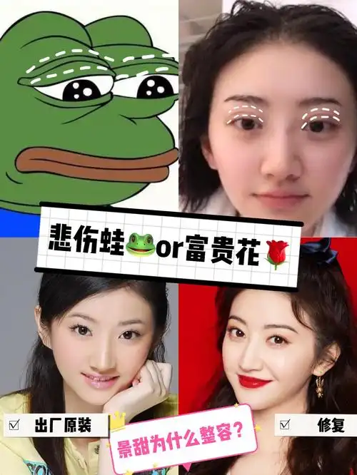 景甜为什么修窄双眼皮?_圈子-新氧美容整形