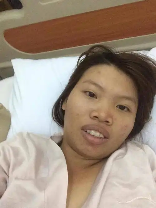 21岁丑女花费10万元整容,从丑女变成漂亮女神,嫁给了富二代_网易订阅