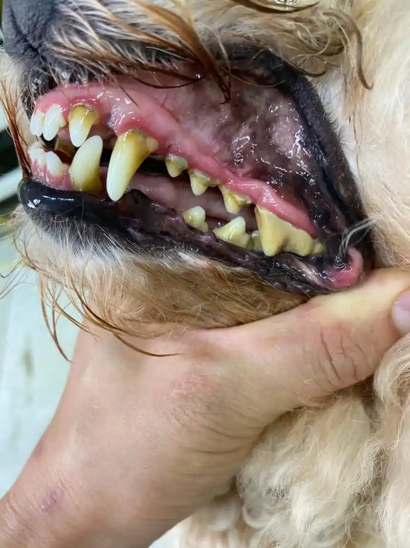 不用打麻醉洗牙.