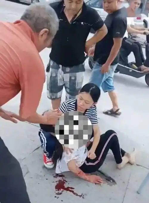 紧急梅州一少女突发车祸头破血流痛苦呻吟