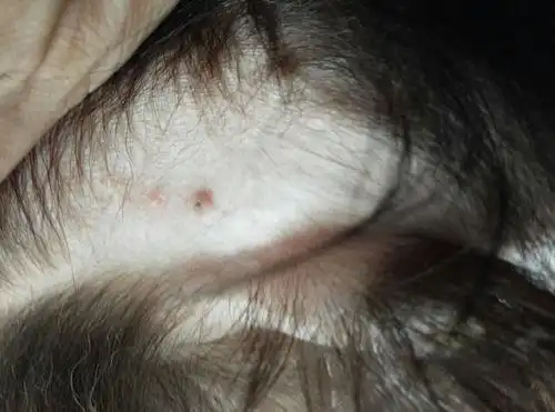 上长了痘痘一样的东西是什么 蛋蛋上长了痘痘一样的东西是什么很痒