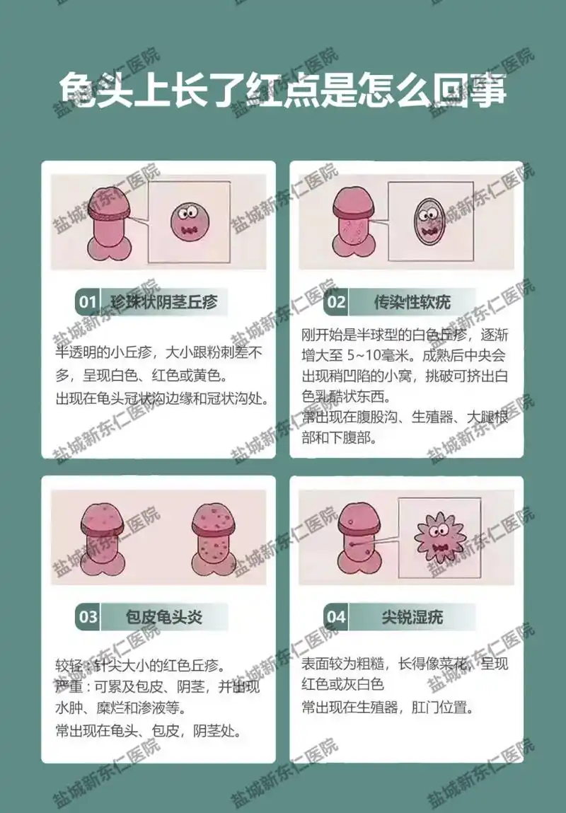 盐城男科# #盐城新东仁男科# #盐城龟头长红点# #盐城龟头上长了旱沣