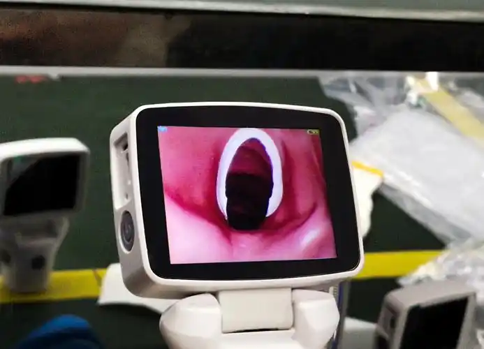 医院医疗设备光学和视频喉镜用于困难的气管插管/视频喉镜价格