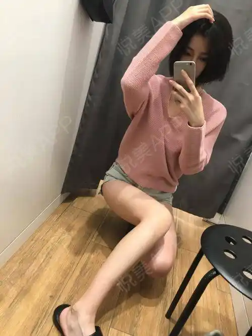 圣嘉新吸脂瘦腿术后满一个月啦,早就能撒欢乱跑了,自从瘦了大腿每天