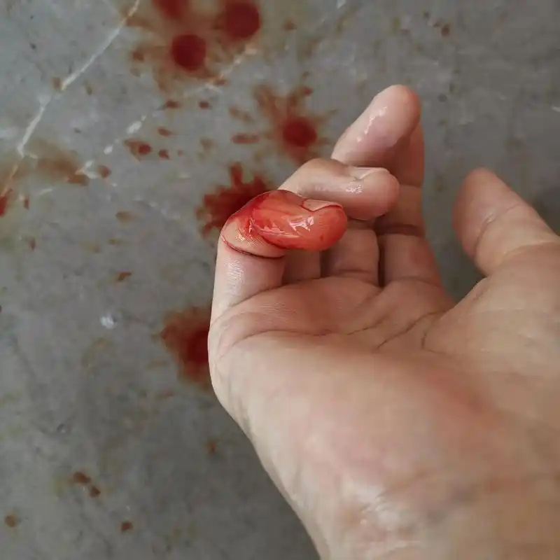 手在流血心在滴血,看着血流不止的那一刻,我没有有矫情,有痛自 - 抖音