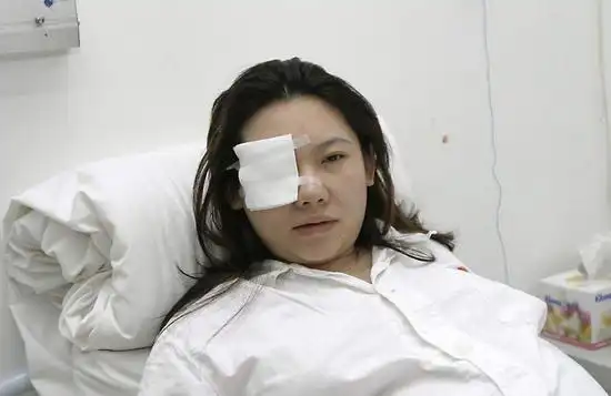 图文:被打孕妇邹雪正在留院观察-眼部包着纱布