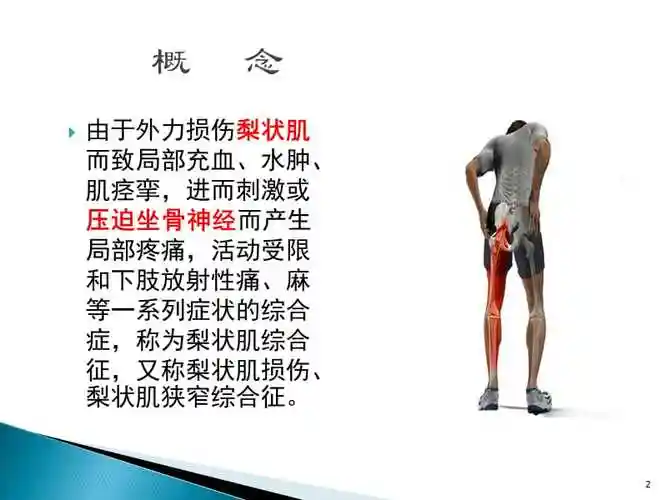 优质医学梨状肌综合征ppt