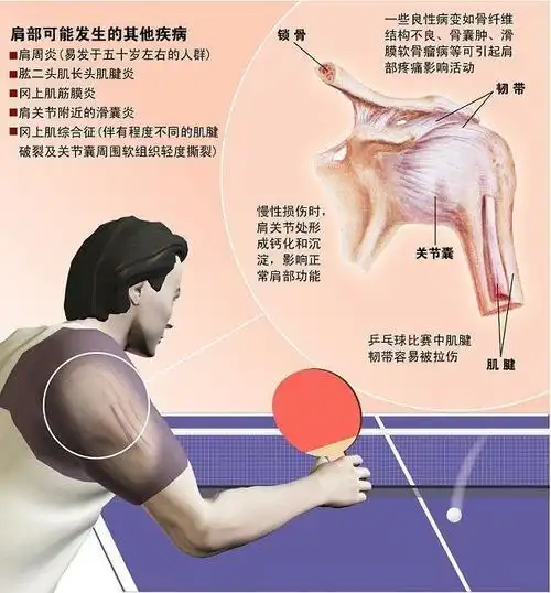 肩部三角肌前,中,后束为什么练不好? 借力,幅度过大,重量过大