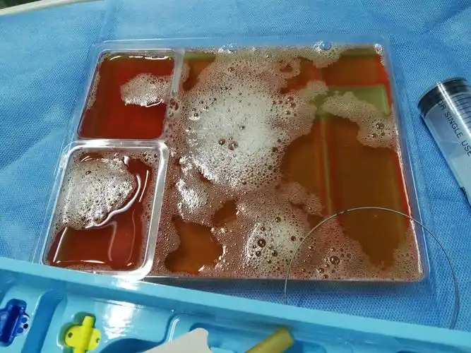 写美篇3月20日下午,行右侧胸腔闭式引流后,血氧明显好转,予拔除气管