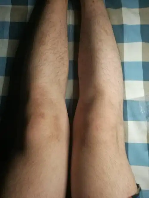 男生腿型不好怎么办?