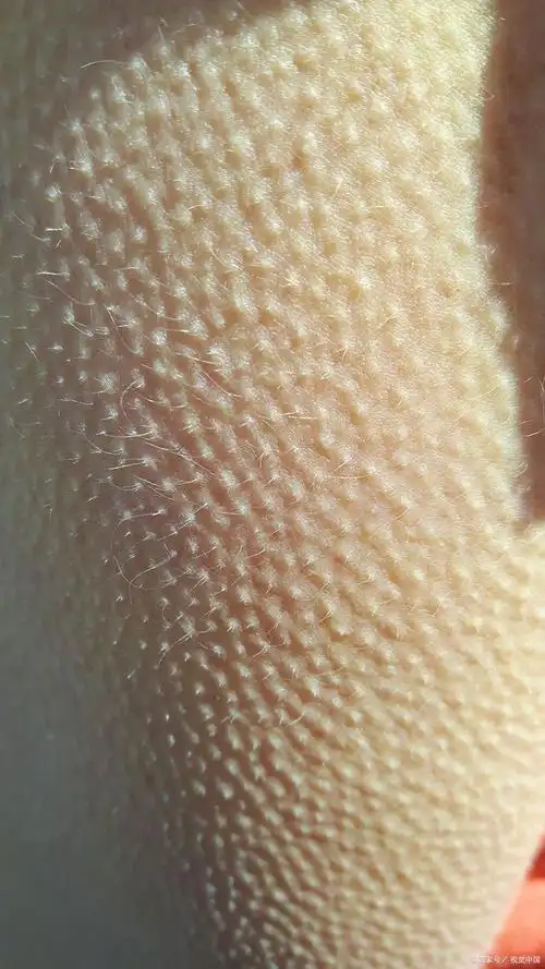 身上老起鸡皮疙瘩是怎么搞的