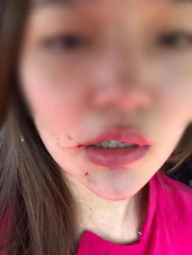 两名空姐一言不合就在飞机上开打 乘务长把空姐脸打肿