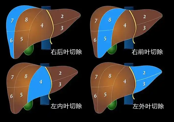 肝脏分段解剖图文教程