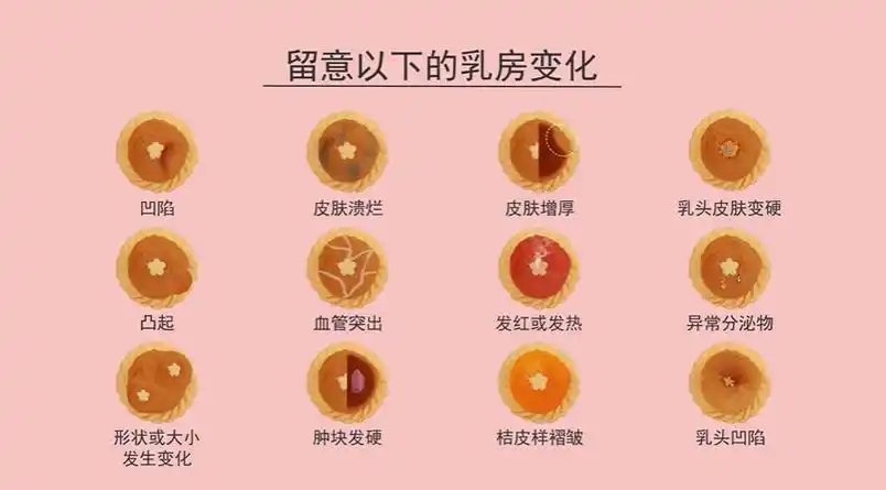 乳房的3分钟自检