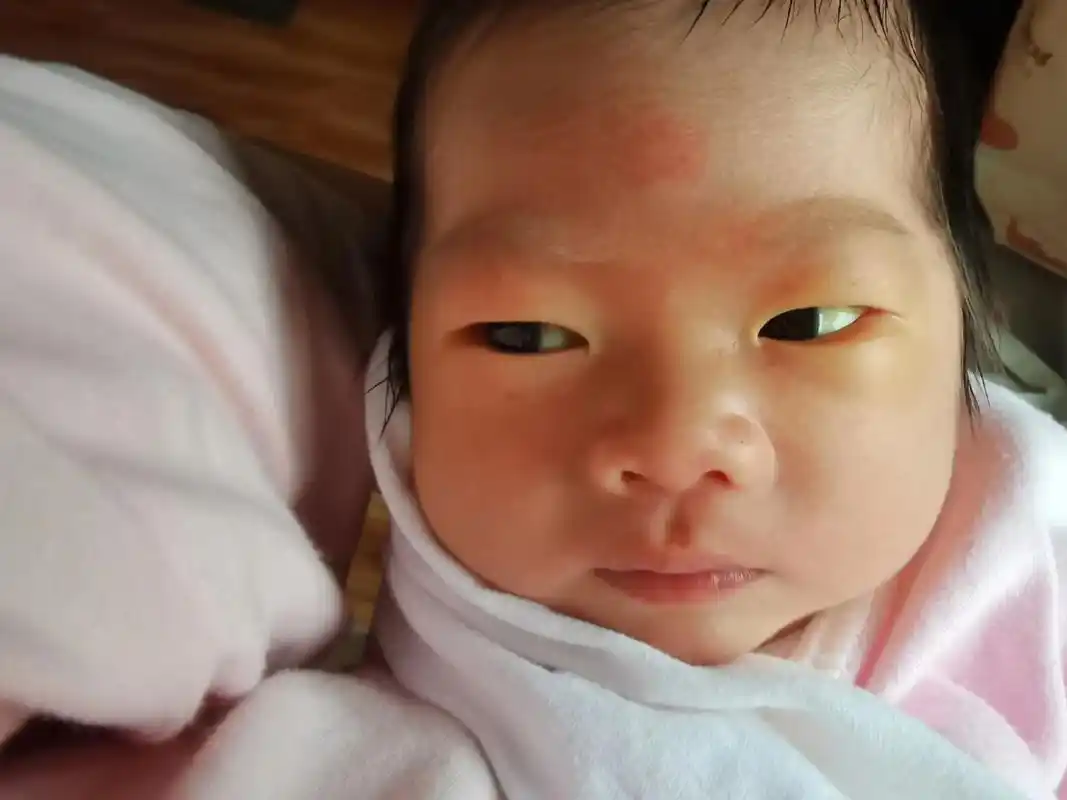 我的好大儿,小眼神厉害着呢!黄疸有点高,照蓝光戴黑的小眼罩