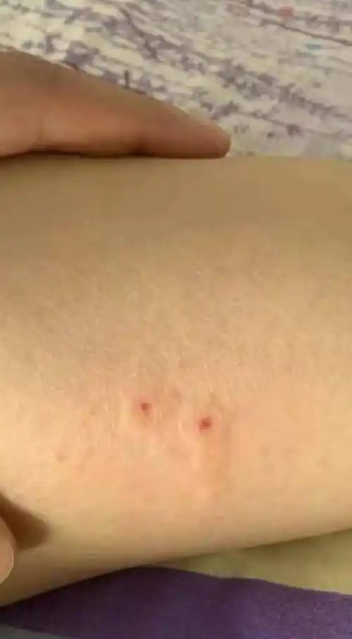 原创我现在好害怕我被这条蛇咬到了大家帮我看一下是不是毒蛇谢谢