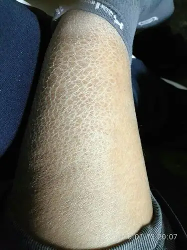 感觉腿特别难看,怎么搓澡都错不多,抹油一会不摸就干的不行,怎么能