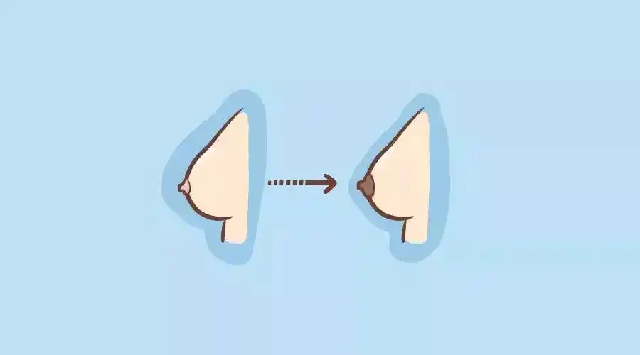 百呵育儿怀孕之后乳房的这些变化都正常吗