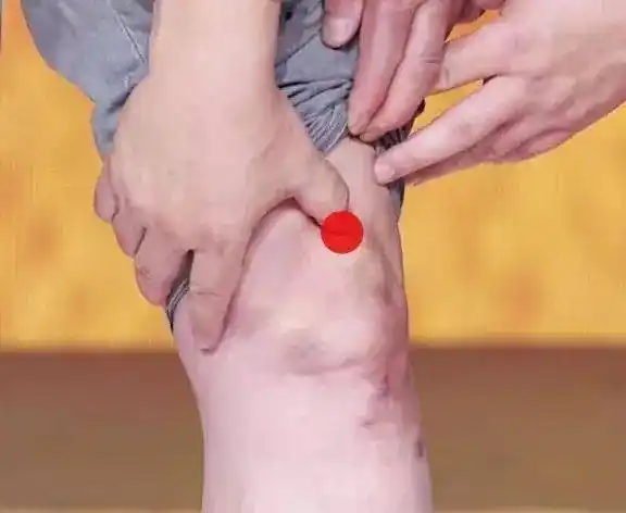 长期如此容易诱发髌上滑囊炎,会出现膝盖肿胀,有压痛感等症状