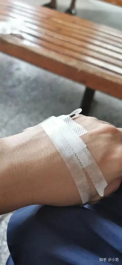 情侣之间舌吻接触到口水不会感觉恶心吗