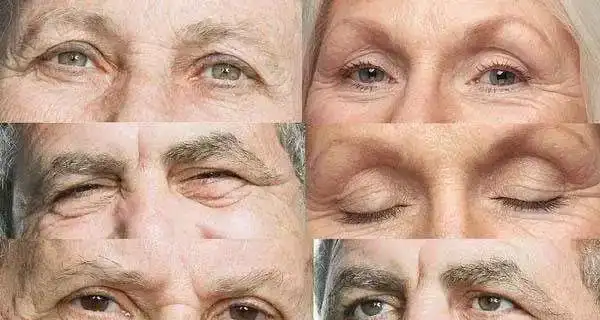 你满脸的皱纹,都是这样产生的!