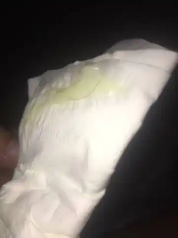 请问这个是宫颈粘液栓吗?目前孕周38 2