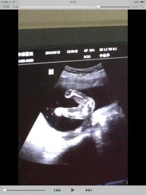 棒!三个月男女胎儿区别图"随时随地"-第1张图片-吉普博客