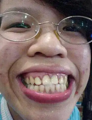 世界上最丑的女人排行榜,心脏不好别看!