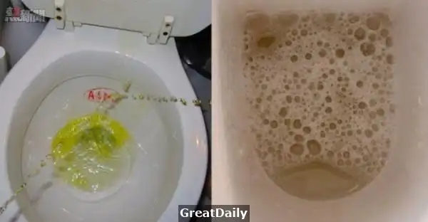 一般人都认为,尿液是人体排出的「垃圾」,其实不然,它是检测健康状况