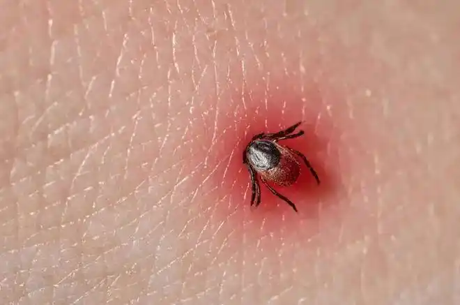 小"蜱虫"到底是一种什么样的虫子,能传播什么疾病?